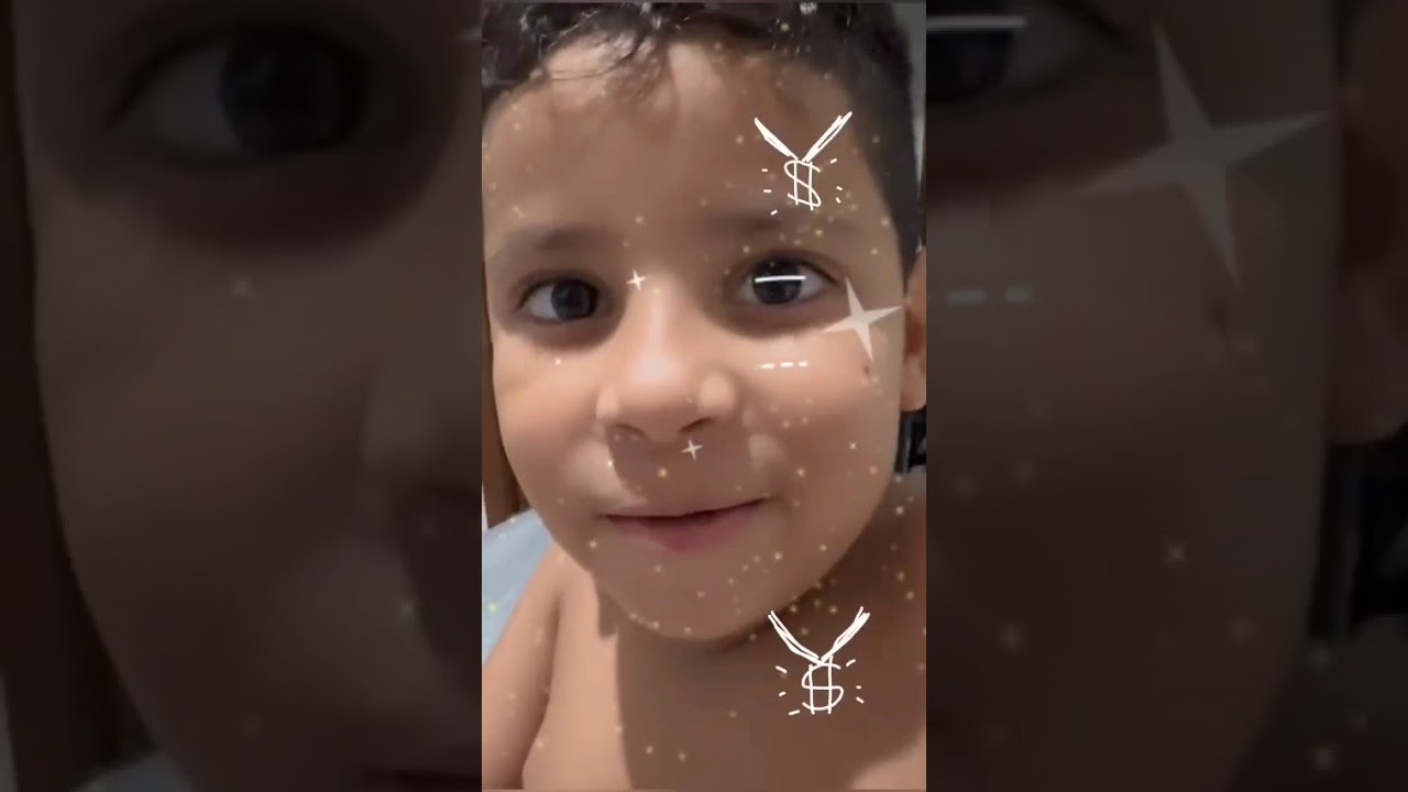 GAEL PERDE  SEU PRIMEIRO DENTE . #criança #diversao #infantil