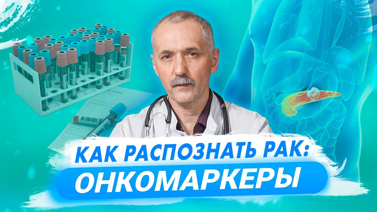 Ранняя диагностика рака. Онкомаркеры / Доктор Виктор
