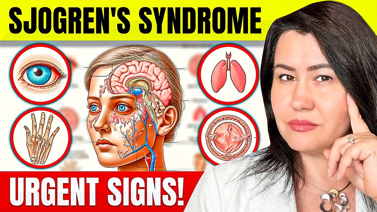 10 URGENT SIGNS of SJOGREN'S DISEASE: Rheumatologist Explains