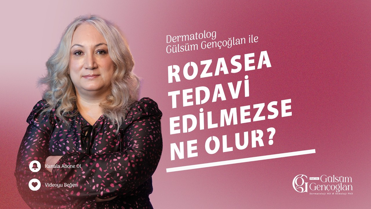 Rozasea Tedavi Edilmezse Ne Olur?