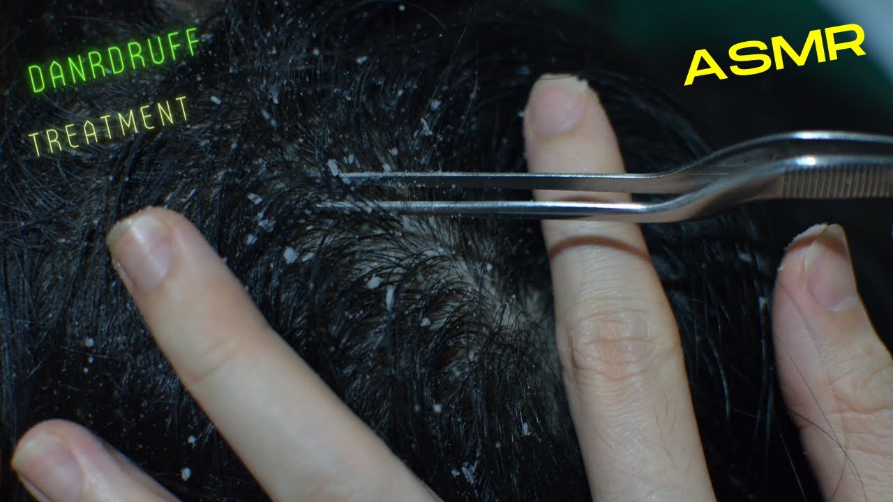 ASMR Attentive Nitpicking Scalp Tingle - Relaxing Scalp Check For Sleep