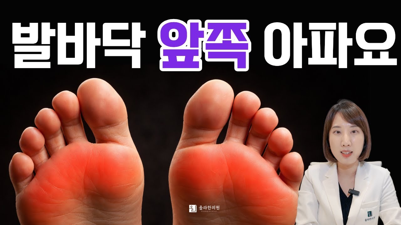 발바닥 앞쪽 통증, 진짜 원인 아직도 못 찾으셨다구요?