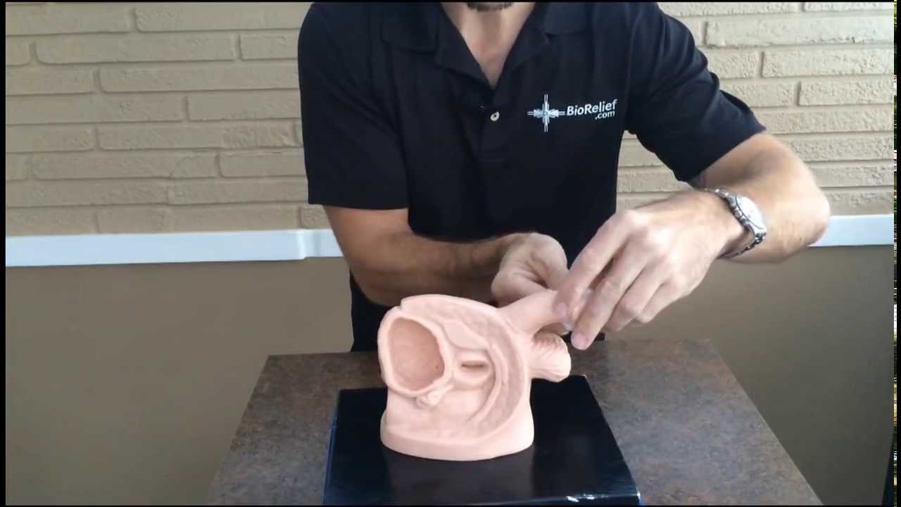 How to Remove a Male External Catheter