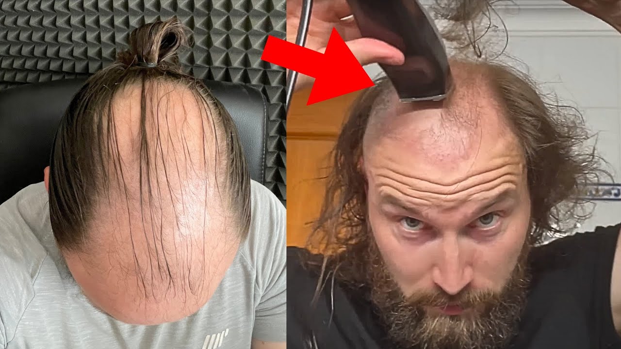 SHAVING MY BALDING HAIR OFF