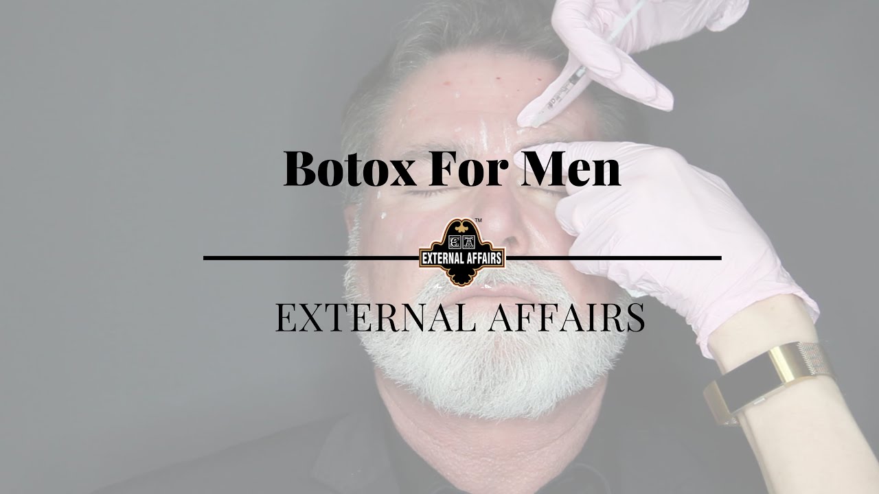 Botox For Men (Dysport/Xeomin) 2019
