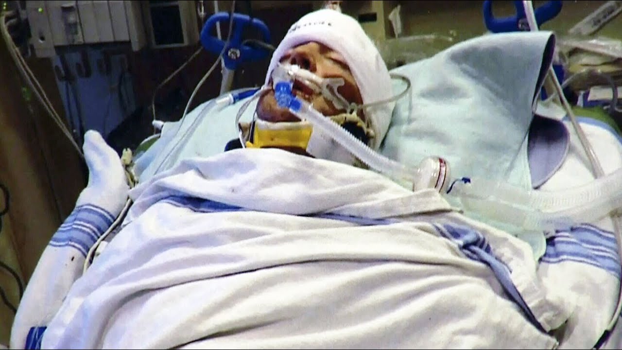 Police warn of series of deadly 'one-punch' attacks