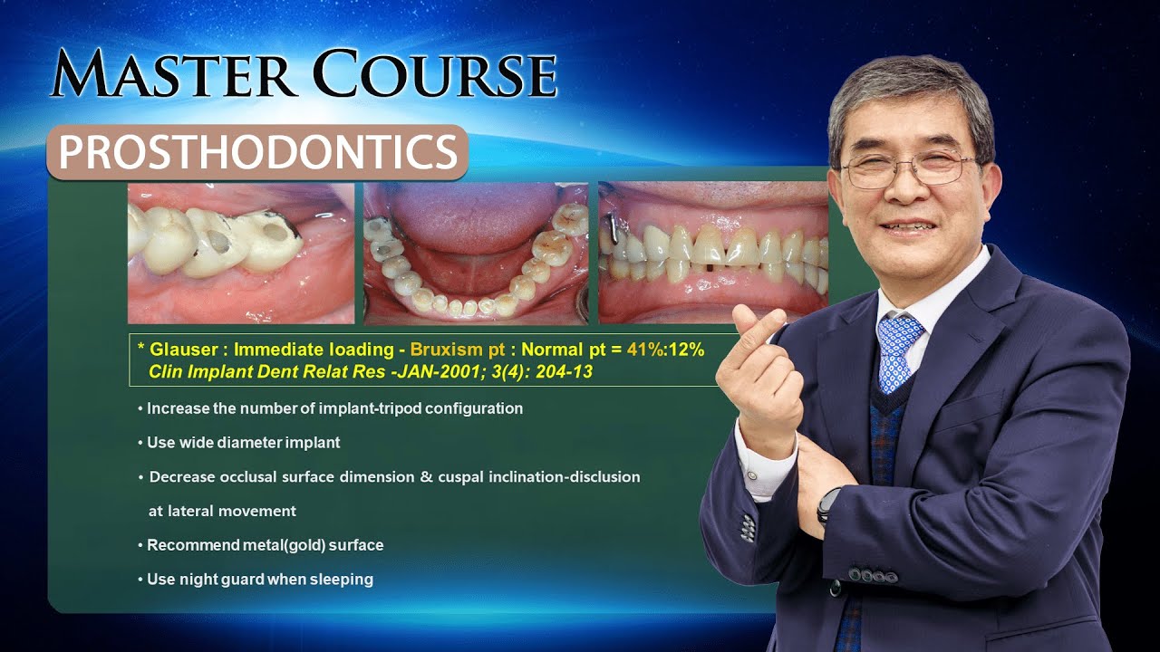 [Master Course - PROSTHODONTICS] Biomechanics & Occlusion of Dental Implant Prosthesis