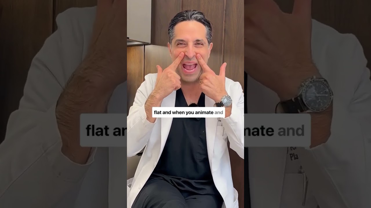 Nasolabial Folds Explained 👄 | What REALLY Causes Smile Lines? #plasticsurgery #smilelines