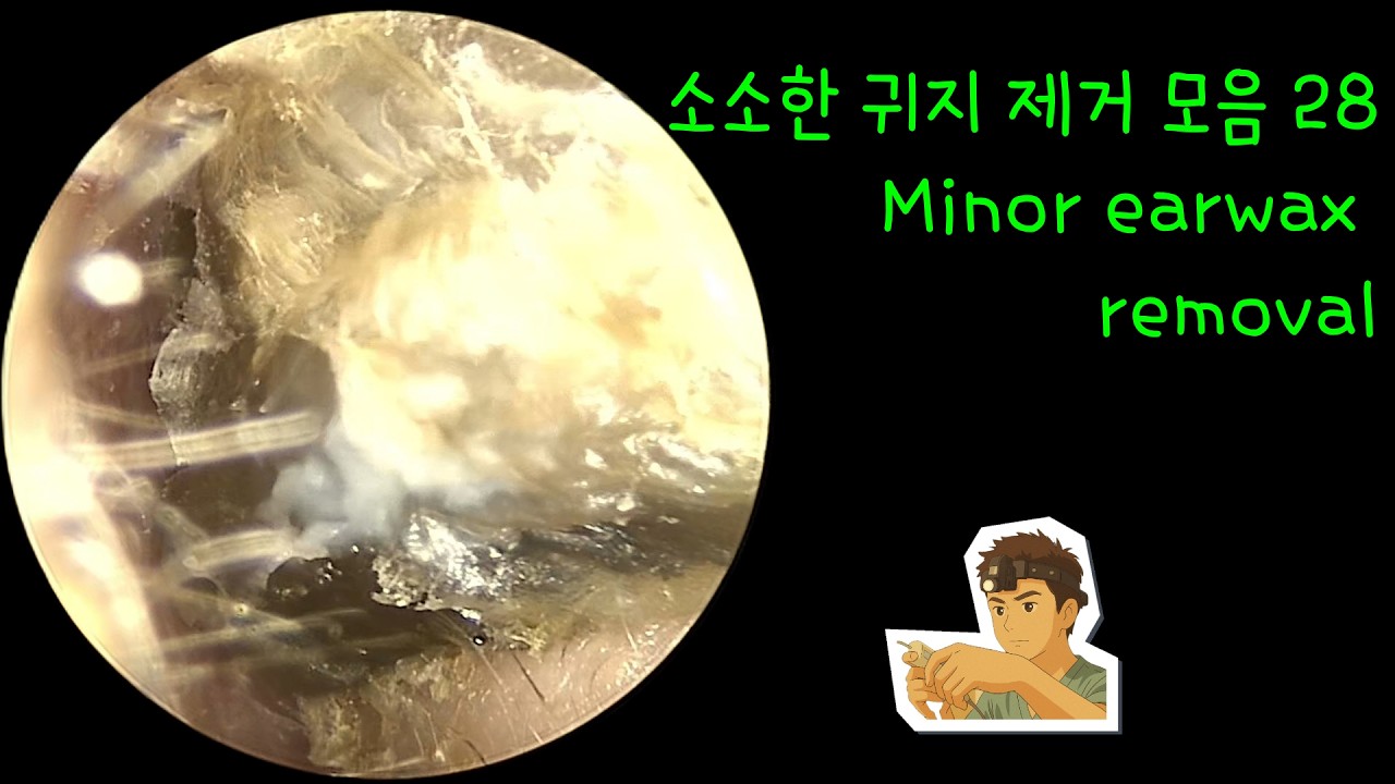 소소한 귀지 제거 모음 28 (Minor earwax removal)
