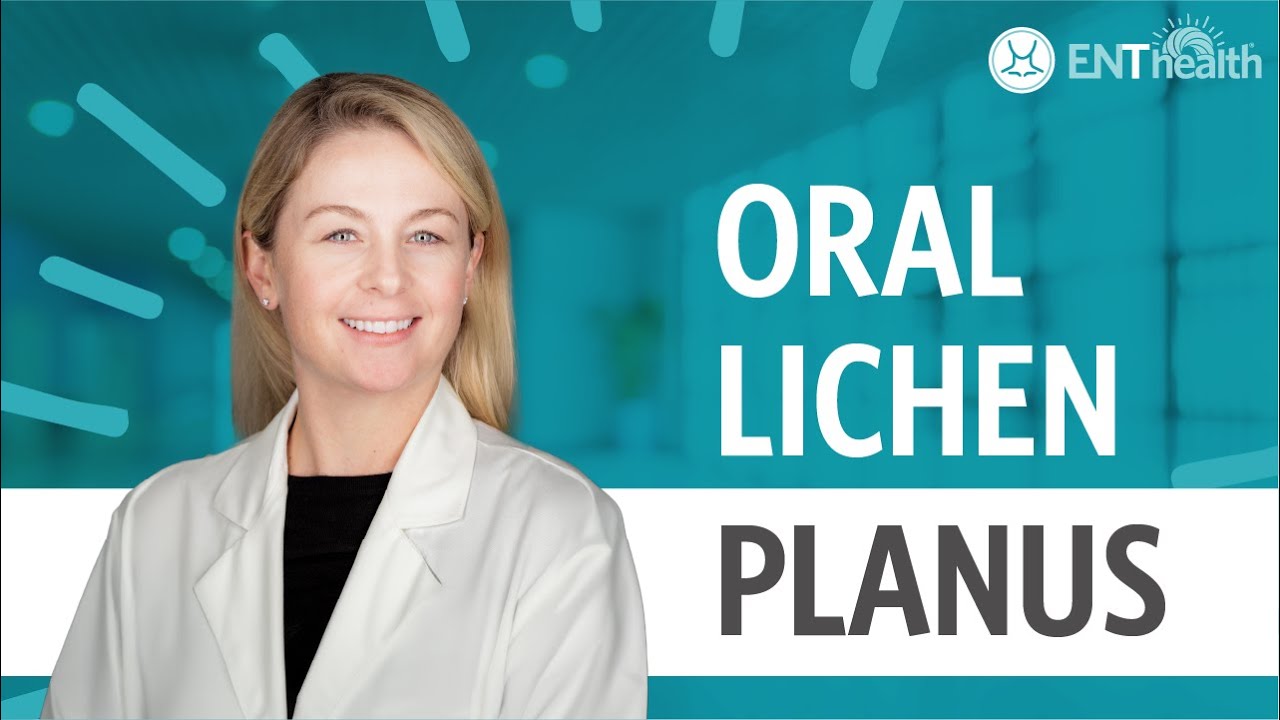 Oral Lichen Planus