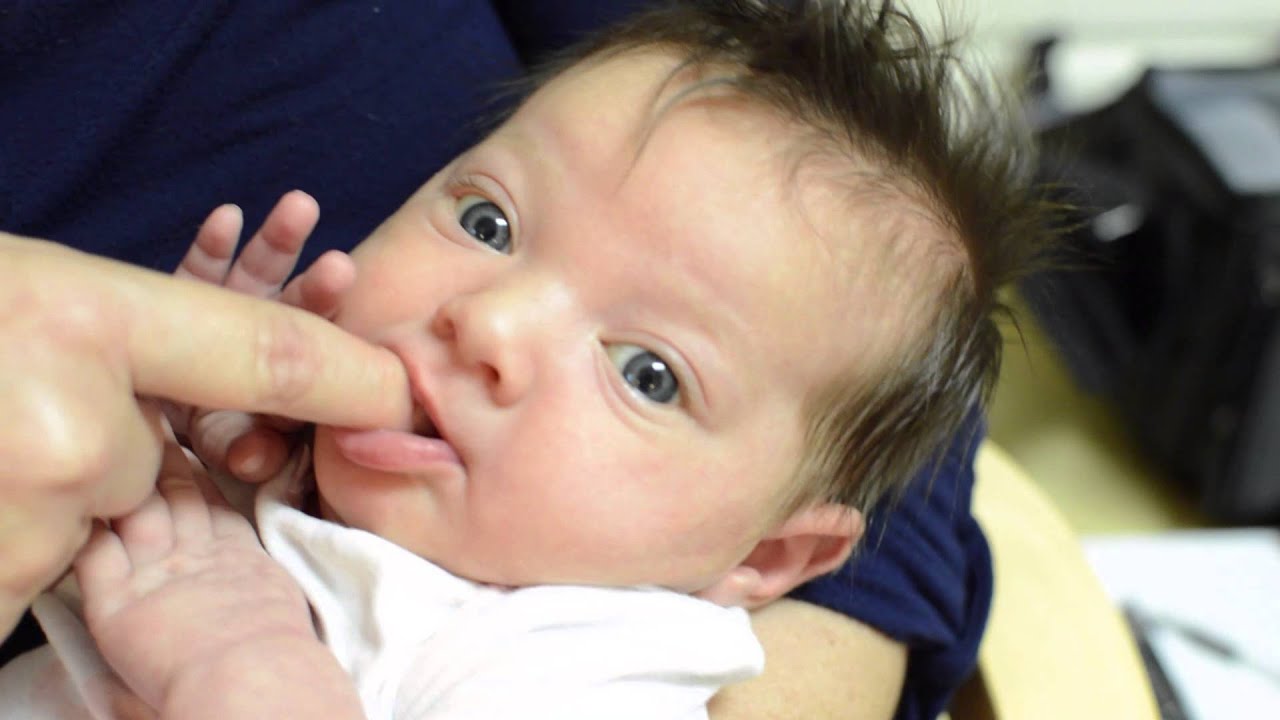 Возможная короткая уздечка языка и губы для родителей