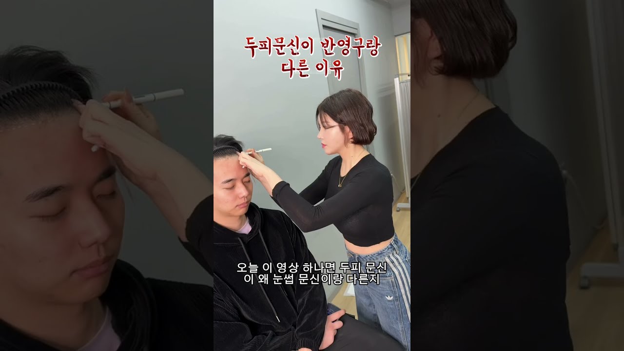 #두피문신smp#서울두피문신#탈모 