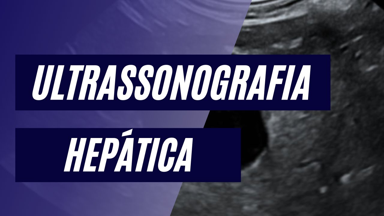 Ultrassonografia Hepática