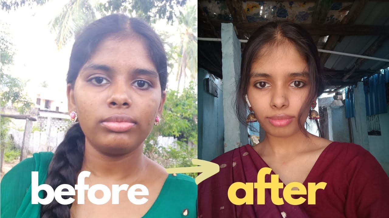 I thought I was ugly for 18 Years | Self-Love Journey | Dark Skin & Self-Love Story |@Naveeda20 