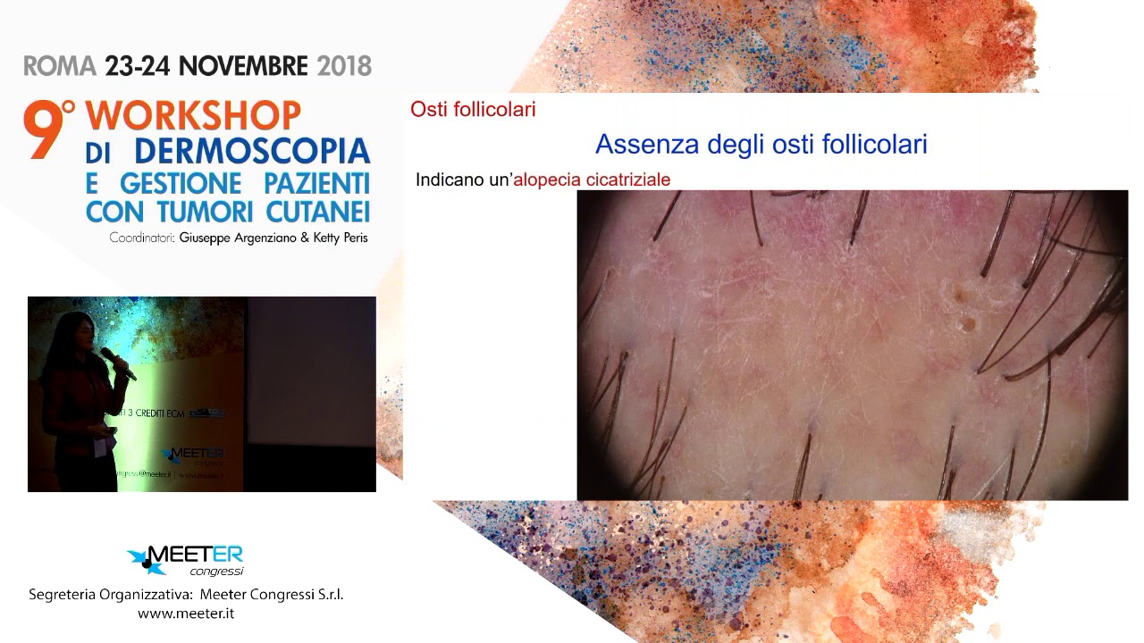 B. M. Piraccini - Tricoscopia