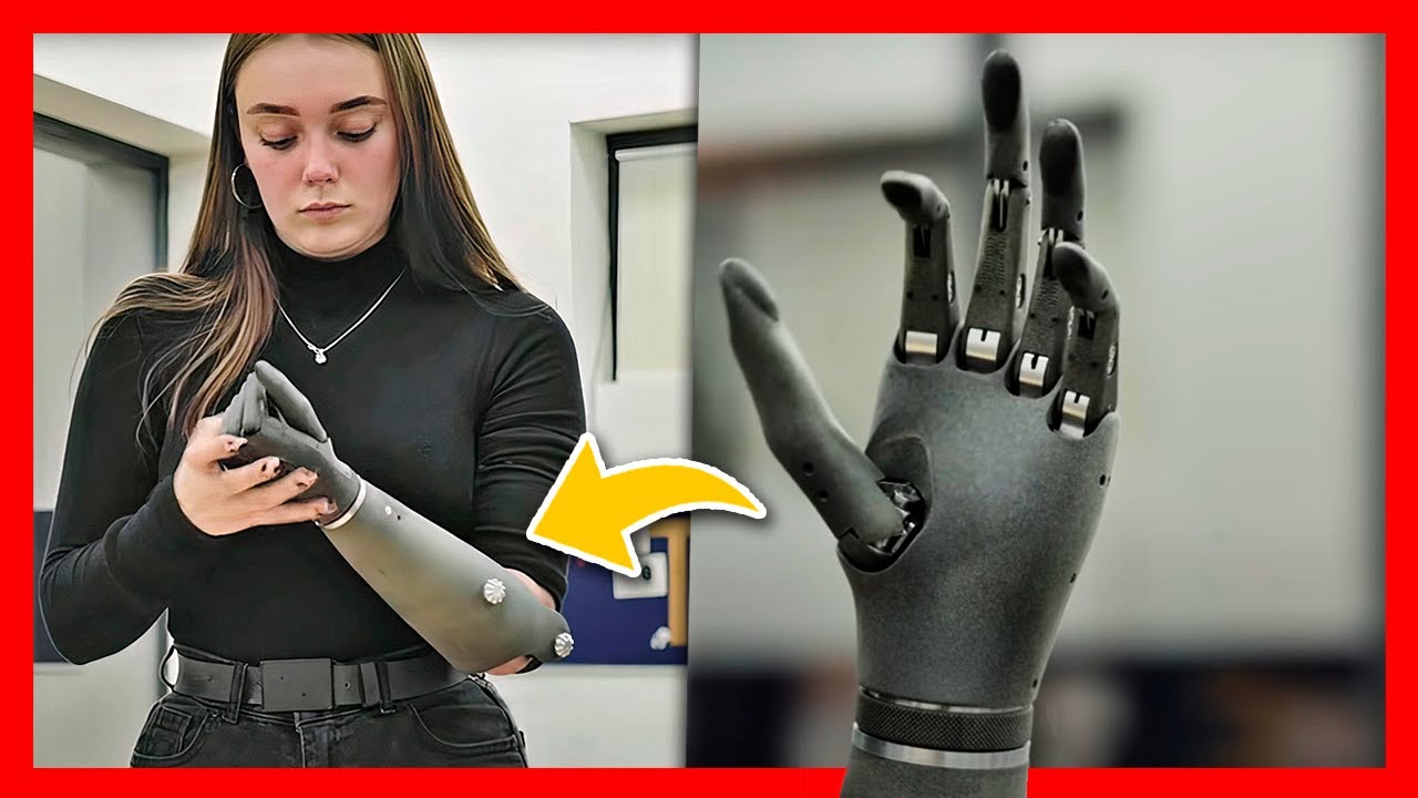 🔥 &iquest;Qu&eacute; es una MANO BIONICA? ► Esper Hand ser&aacute; la Pr&oacute;tesis del FUTURO