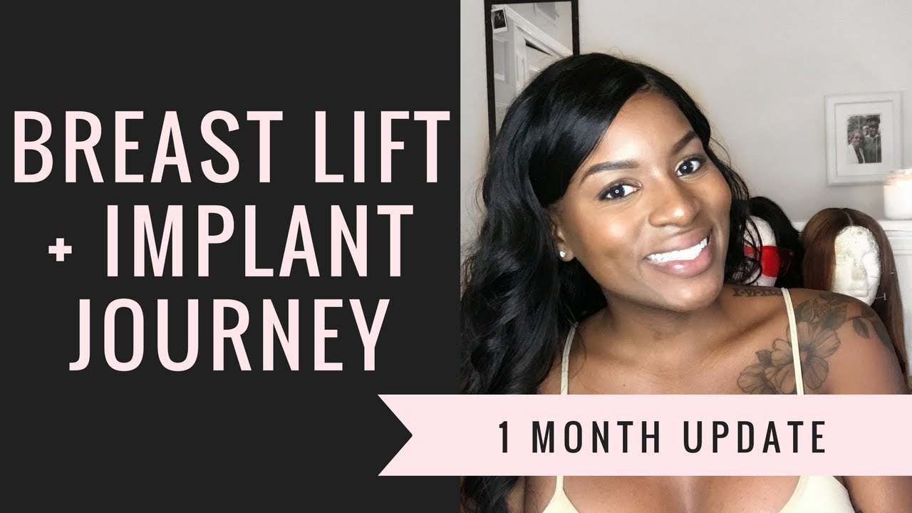 BREAST LIFT & IMPLANT 1 MONTH UPDATE