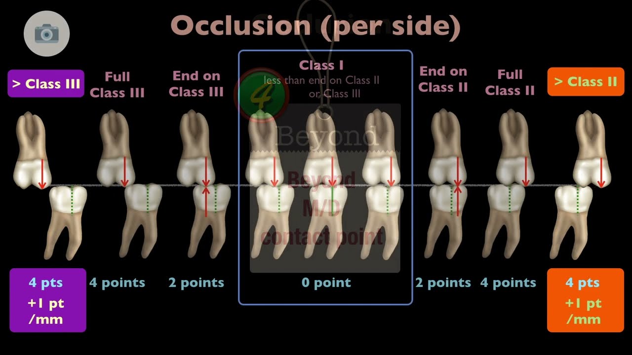 Discrepancy Index｜【Chris Chang Ortho】CC532