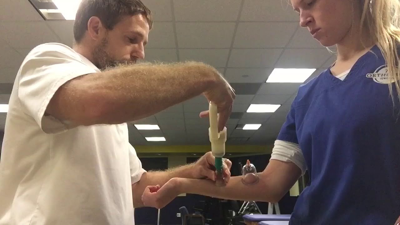 Cupping medial epicondylitis
