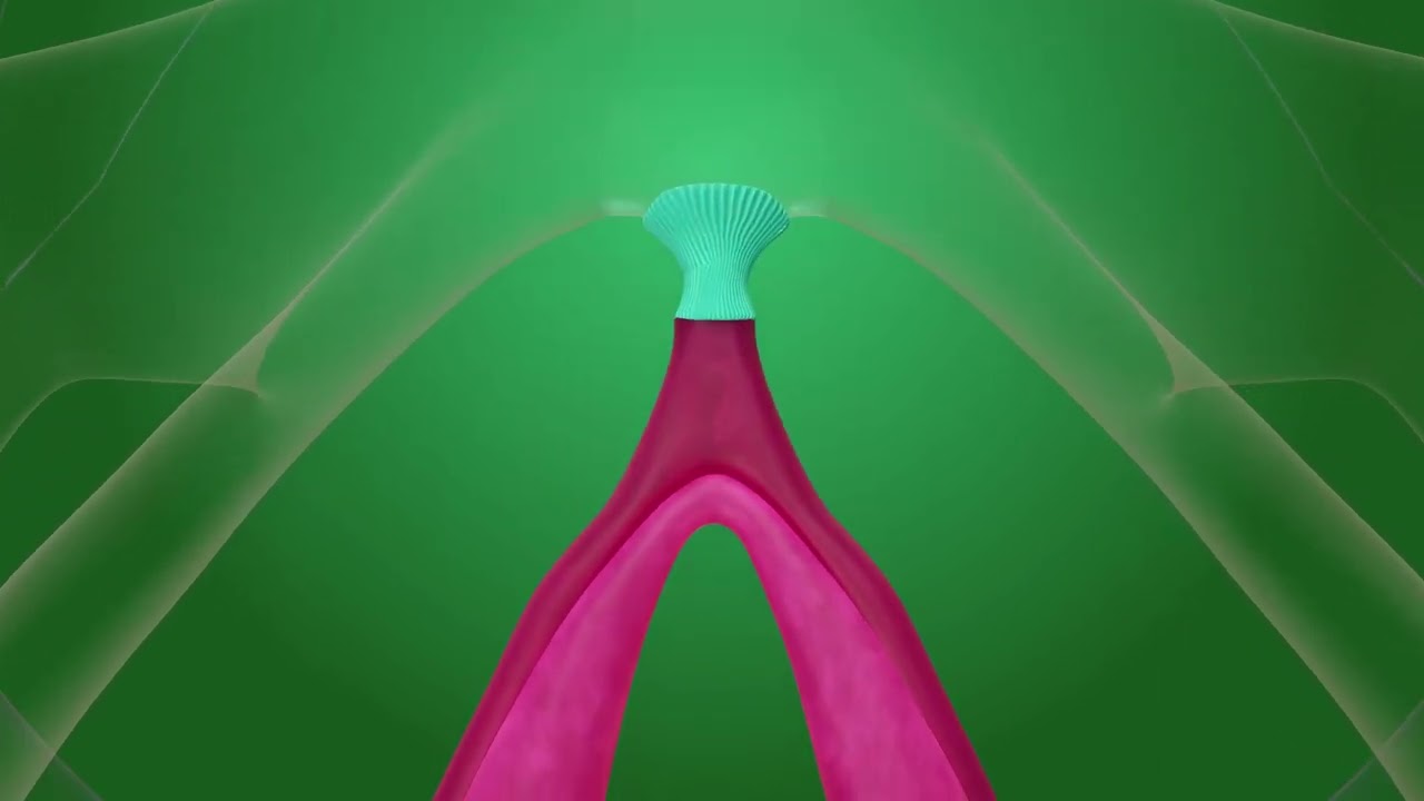 La chirurgie réparatrice de l'excision