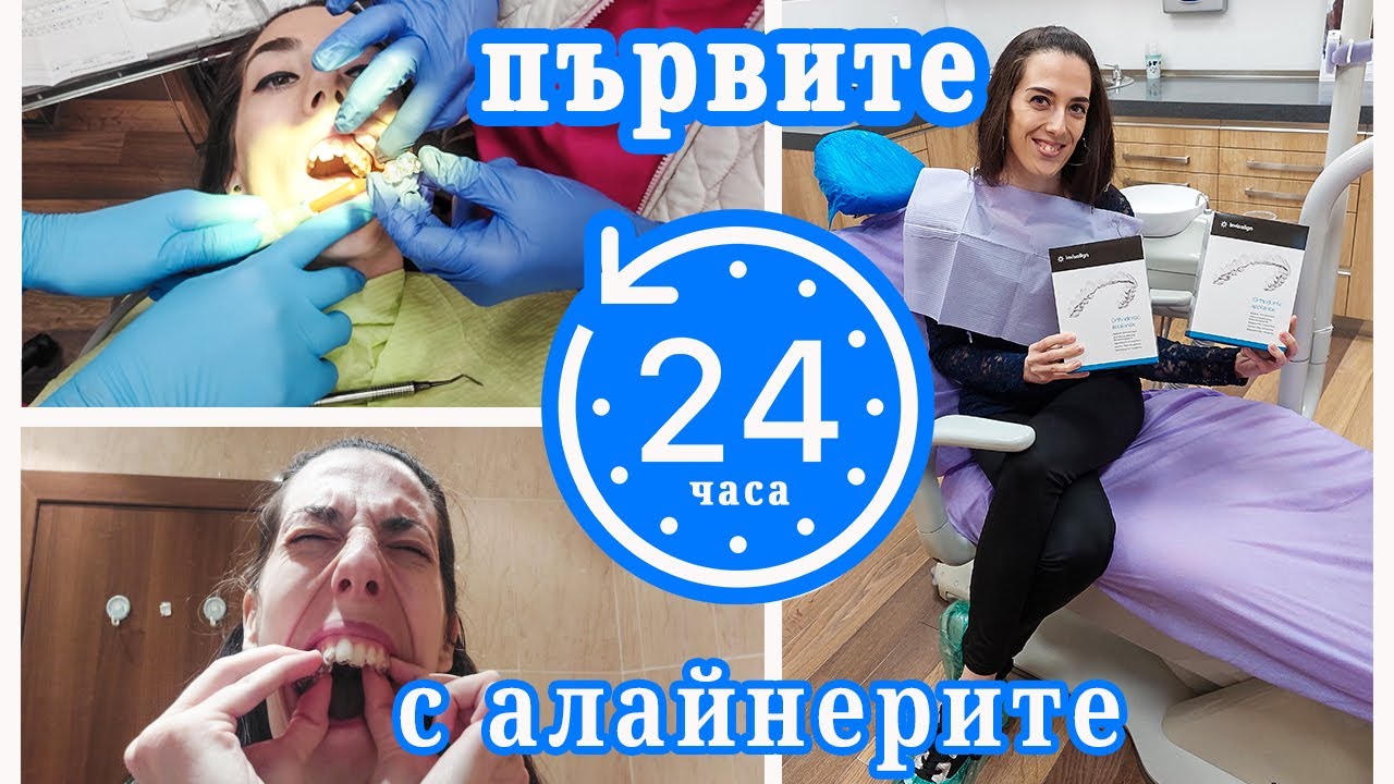 Първите 24 часа с алайнерите на Invisalign - ep. 3