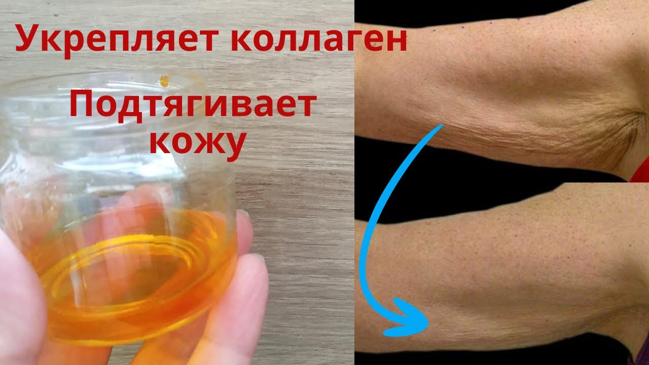 Подтянет зрелую и дряблую кожу! Золотое масло для укрепления коллагена. Рецепт №3