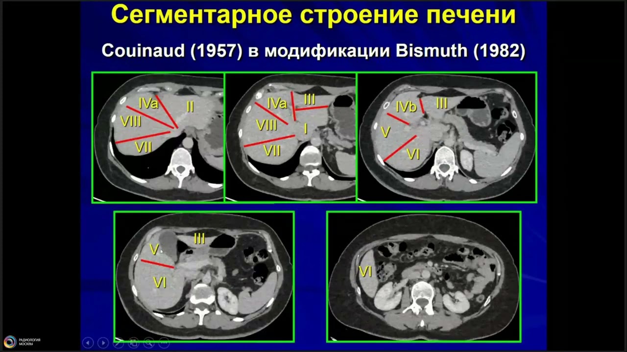 Нормальная и вариантная анатомия печени, желчевыводящих путей и сосудов