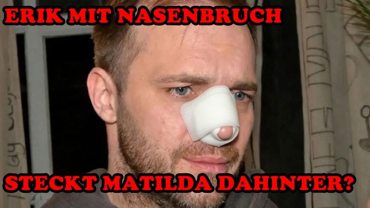 Skandal bei GZSZ: ERIK MIT NASENBRUCH – STECKT MATILDA DAHINTER?