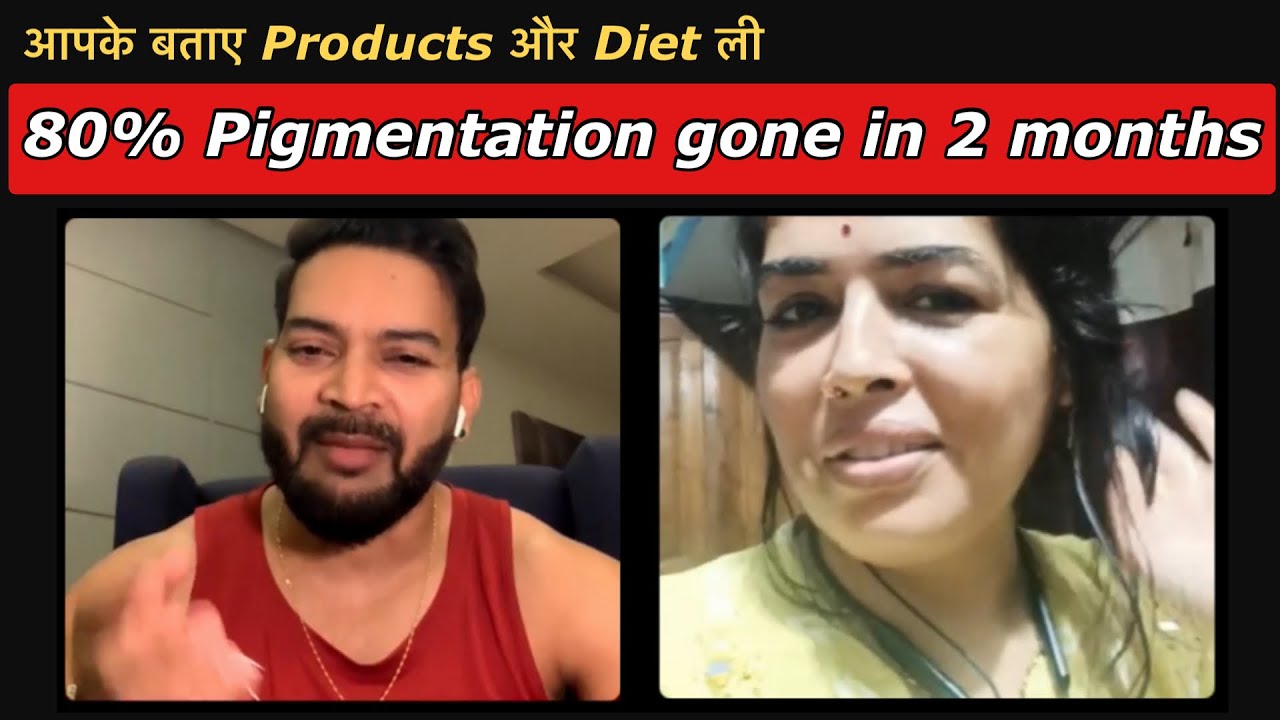 My 80% Pigmentation gone in 2 months. आपके बताए Products और Diet ली I