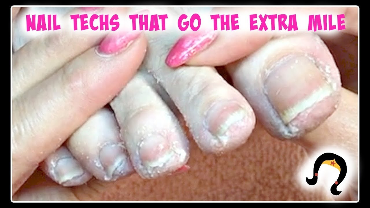 XXX Extreme Dead Skin Removal Toenail Transformation Pedicure Tutorial