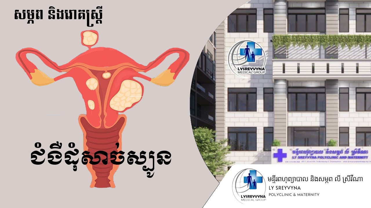 ជំងឺដុំសាច់ស្បូន