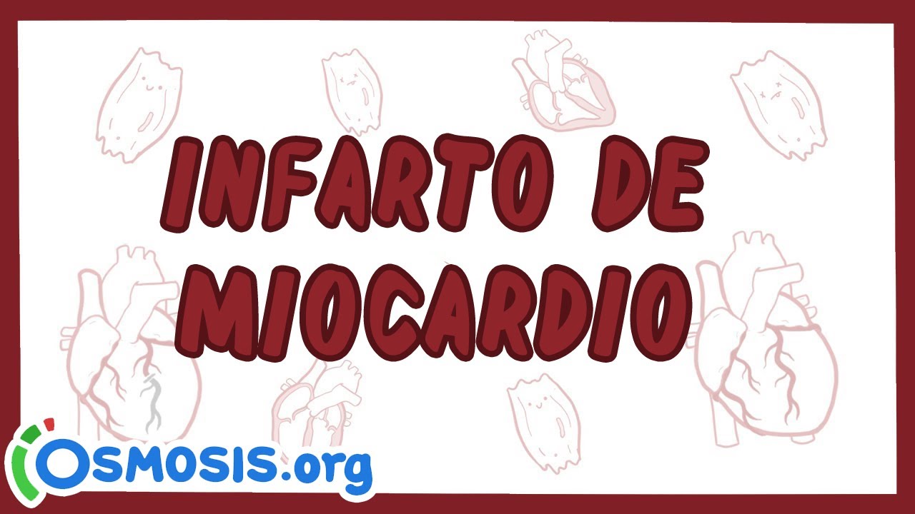 Infarto de Miocardio - Ósmosis en Español