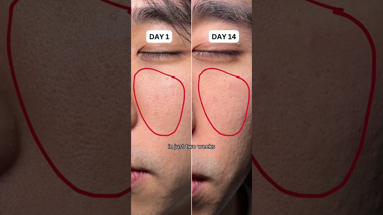 how to reduce the appearance of your pores I EQQUALBERRY BAKUCHIOL SERUM 💜 #shorts