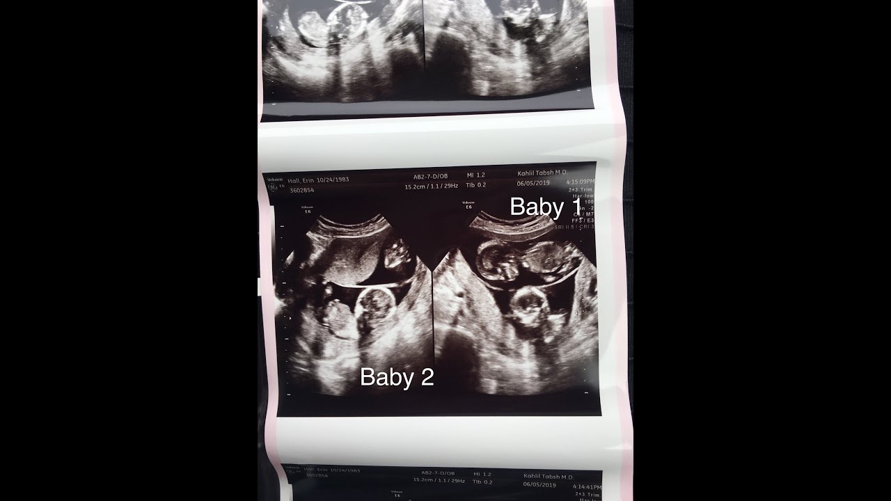 Twin Pregnancy Reveal - Telling our family and friends about Wyatt & Emmett