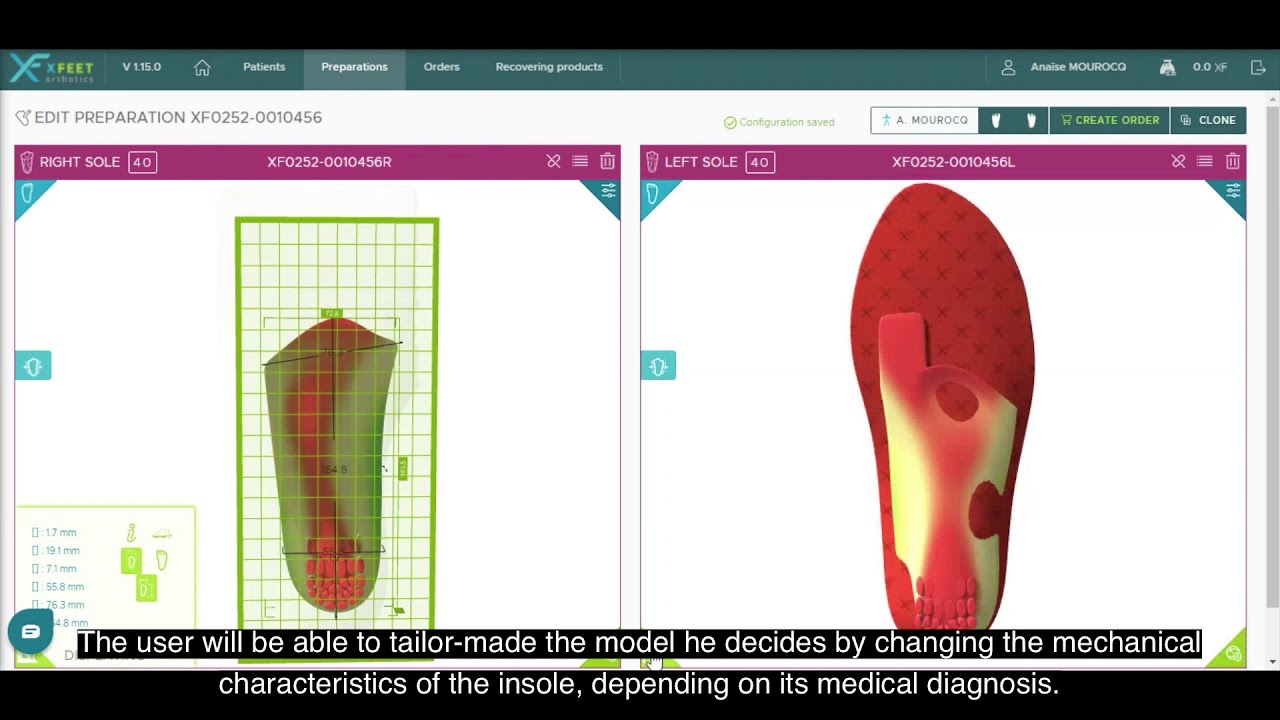 XFeet - digital revolution in podiatry : 3d printed orthopedic insoles