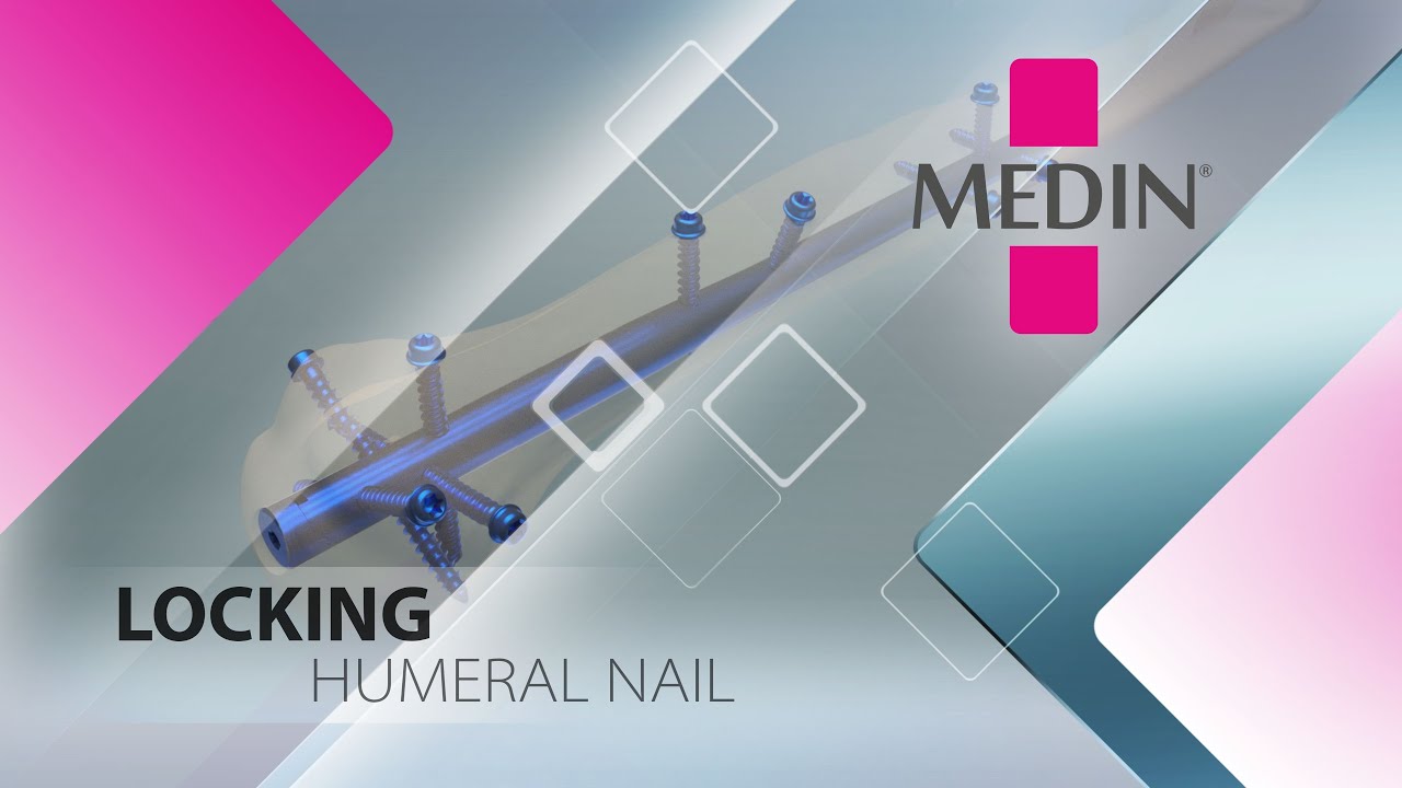 Locking humeral nail