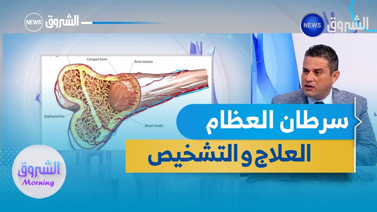 سرطان العظام.. التشخيص و العلاج