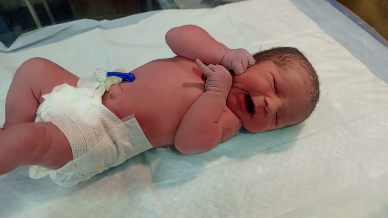 Newborn Suddenly Turned Blue! Critical Emergency Caught on Camera 