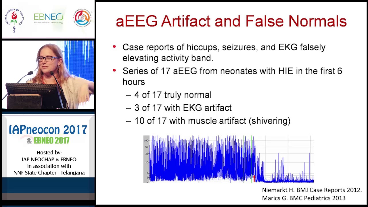 Role of aEEG in Cooling  - Dr Courtney Wusthoff