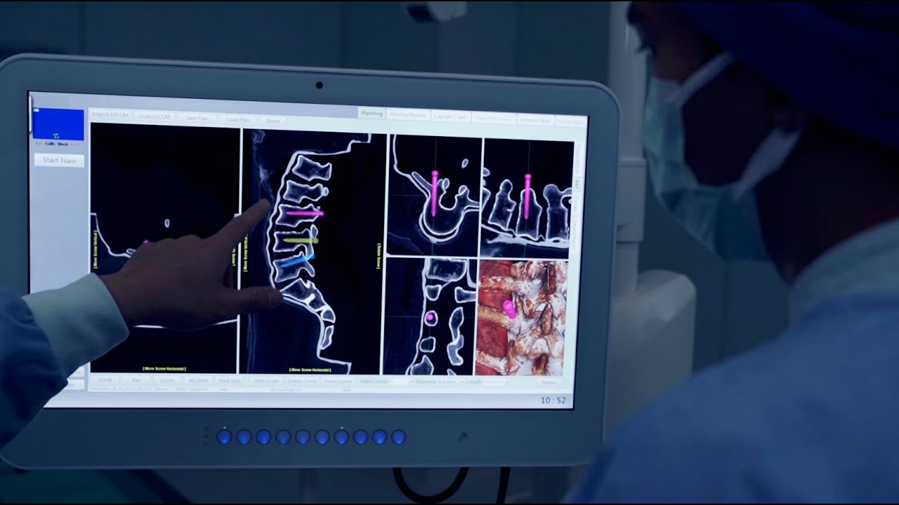 WatchTower&trade; Spine Navigation and Robotics System - Real-Time 3D Enabling Technology