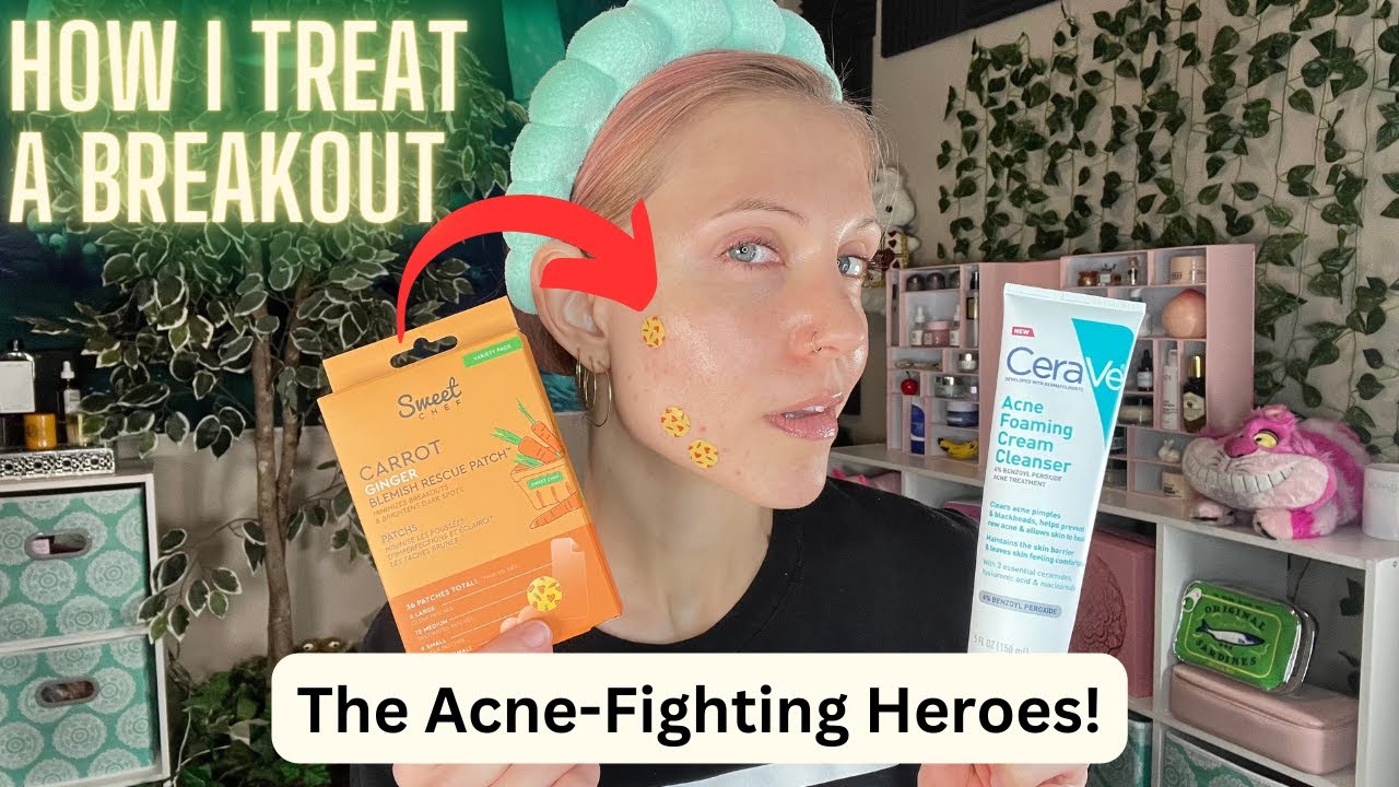 The Breakout Routine - How I Clear My Skin!