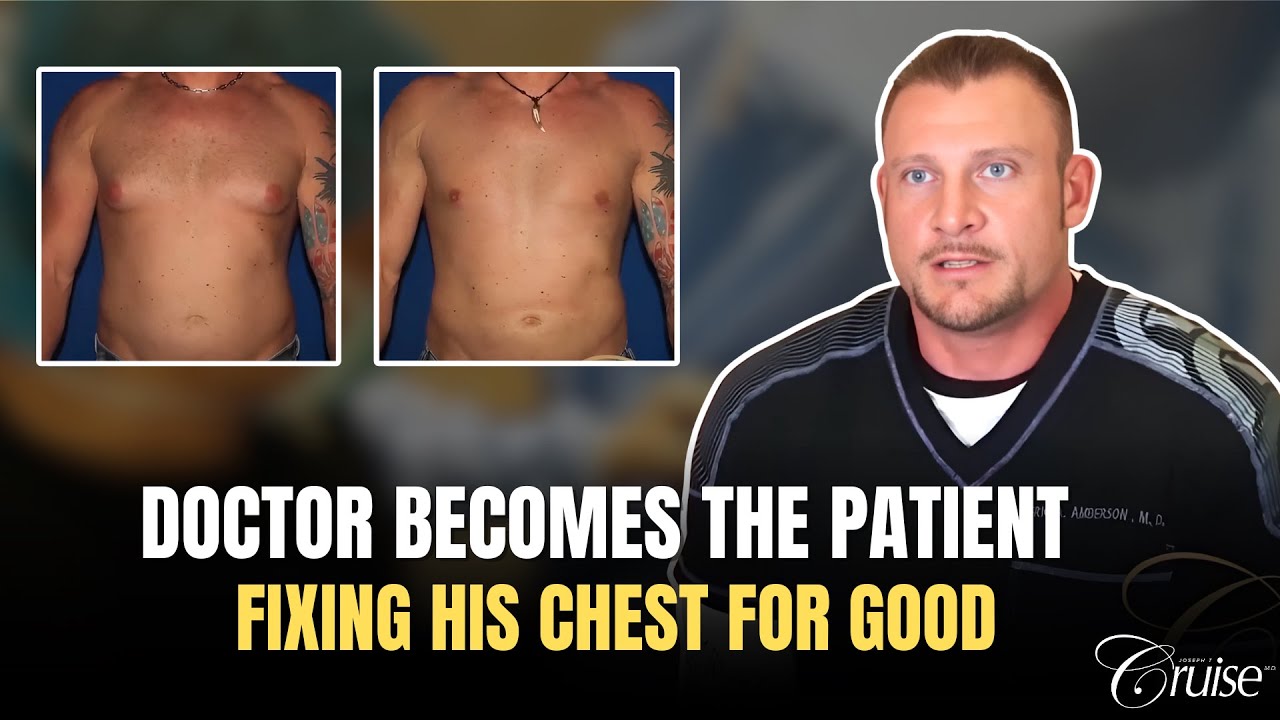ER Doctor has Gynecomastia Surgery to Improve Body Image | Man Boob Surgery