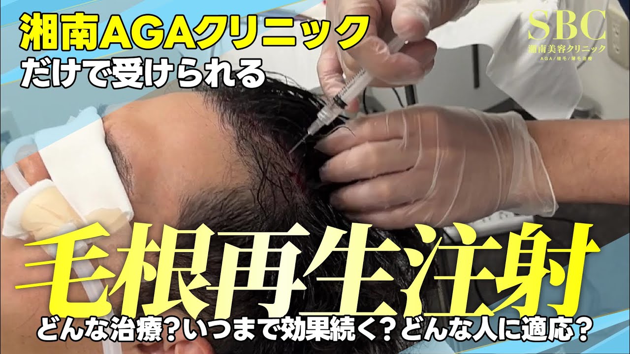 【薄毛に直接注射】1回の治療で最短1ヶ月で効果実感！毛根再生注射を医師が解説します