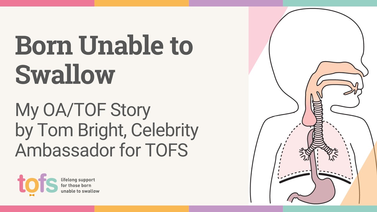 Born Unable to Swallow: My OA/TOF Story by Tom Bright, Celebrity Ambassador for TOFS