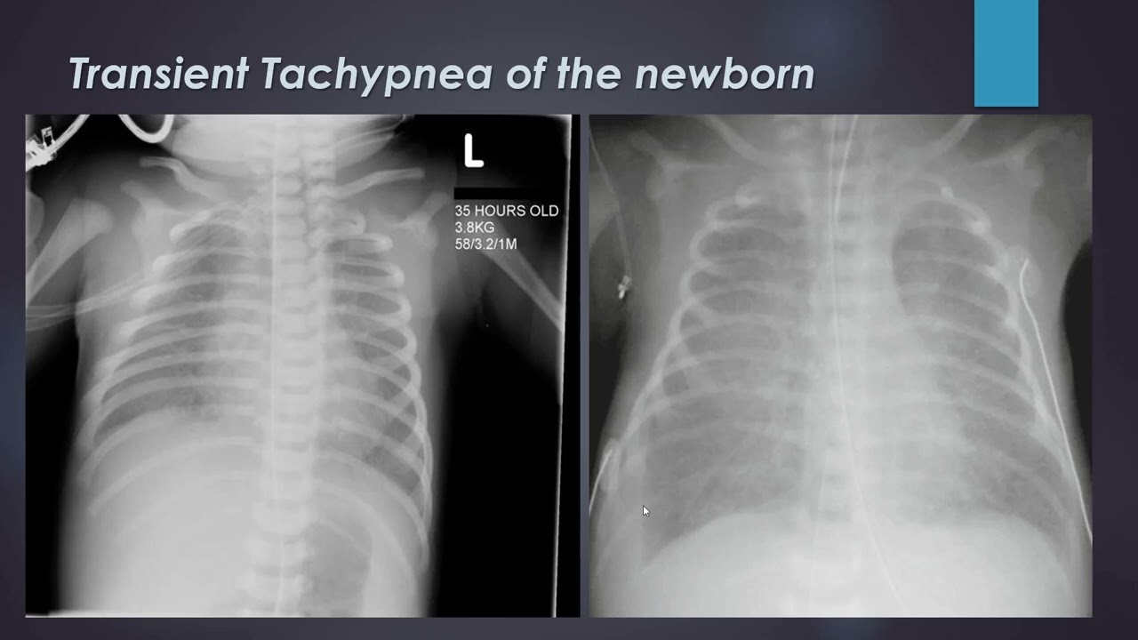 Pediatric Radiology, part 1 , prof. Mohamed Eltomy