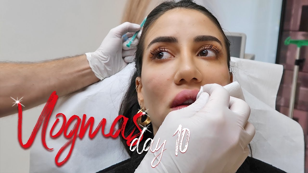 Removing The Filler From My Lips #VLOGMAS10 | Tamara Kalinic
