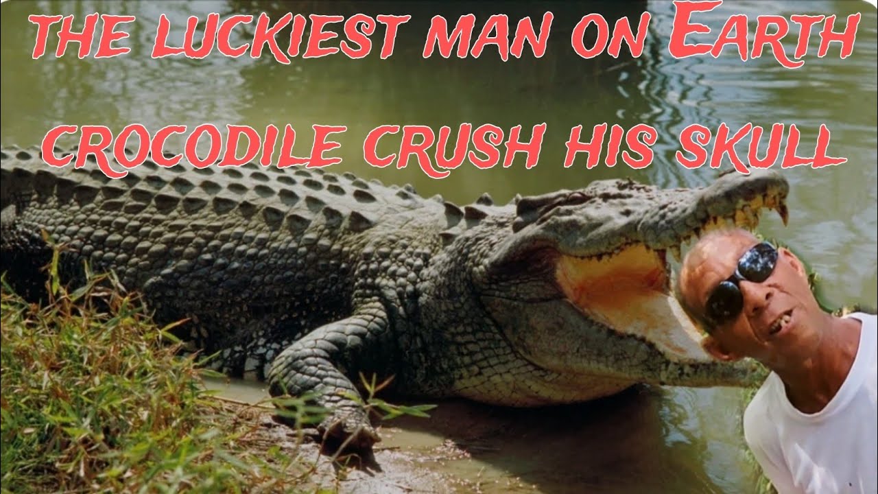 Survivor's Tale: Man Bitten 9 Times By 🐊 In Woodland Life Story 2024