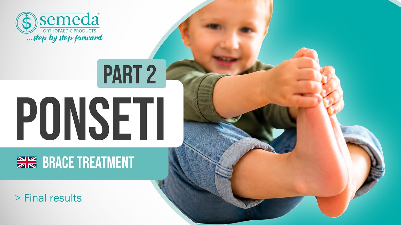 Ponseti | Part 2 - Brace Treatment with final results  ©Semeda GmbH