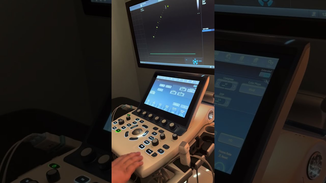 GE S60 Ultrasound Machine Basic User Guide