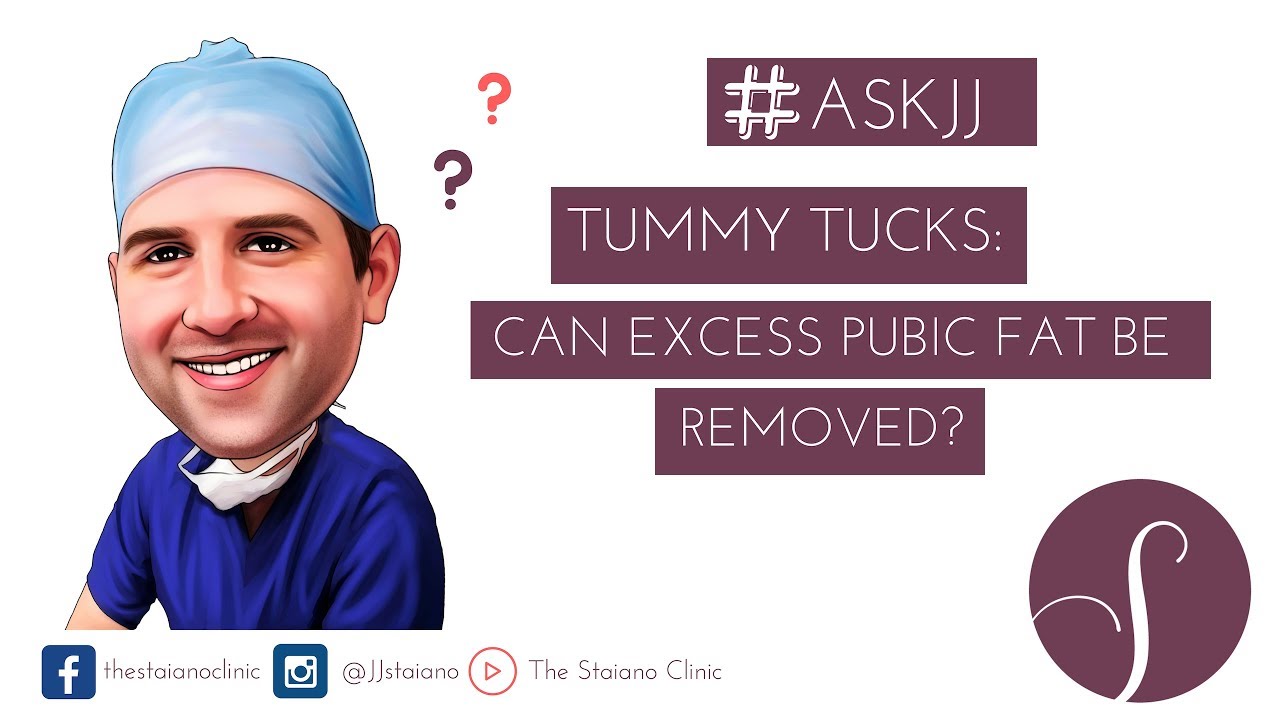 Tummy Tucks: Can Excess Pubic Fat Be Removed?
